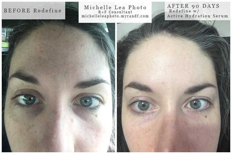 Why I became a Rodan and Fields Consultant, anti aging skin care, rodan and fields redefine before and after